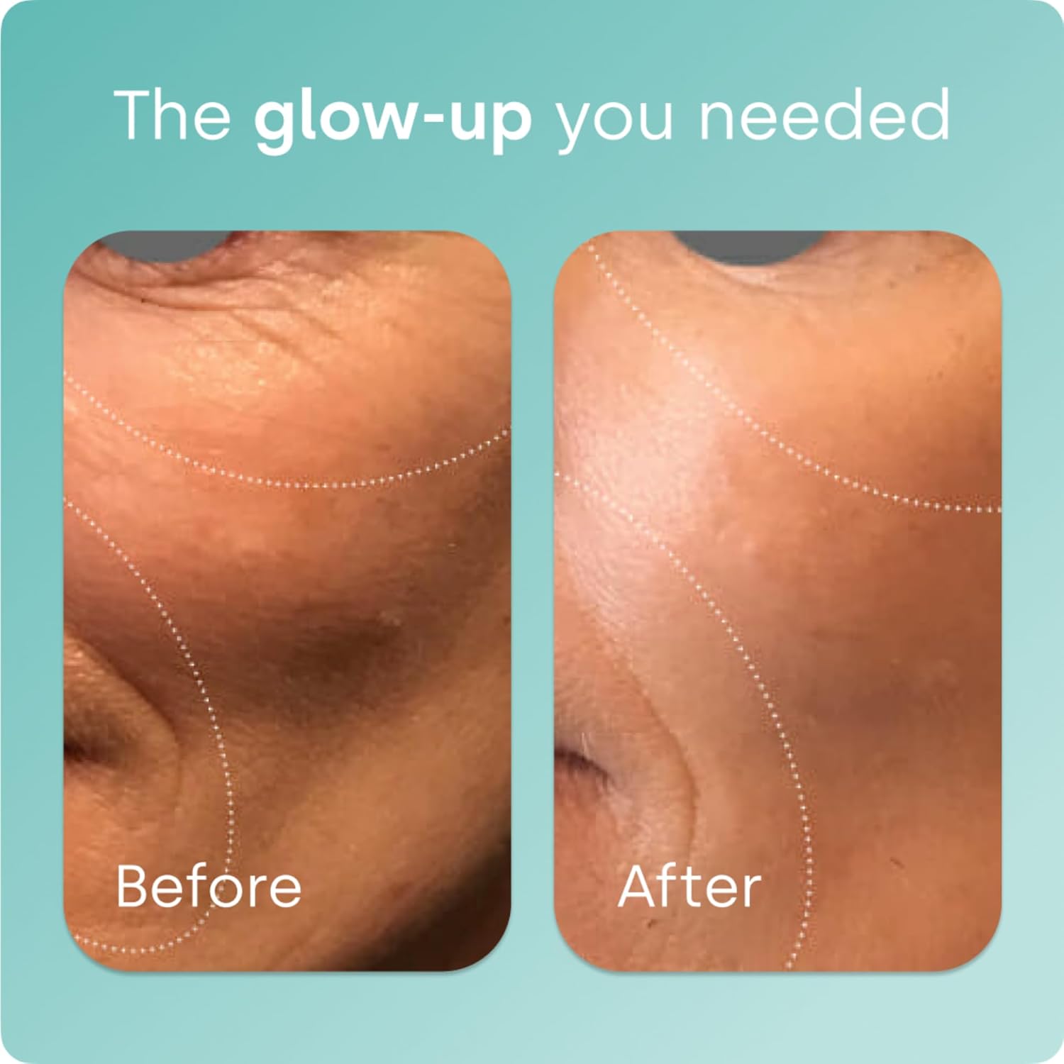 مکمل کلاژن‌ساز پوست، مو و مفاصل Biosil مدل Collagen Booster، 180 کپسول