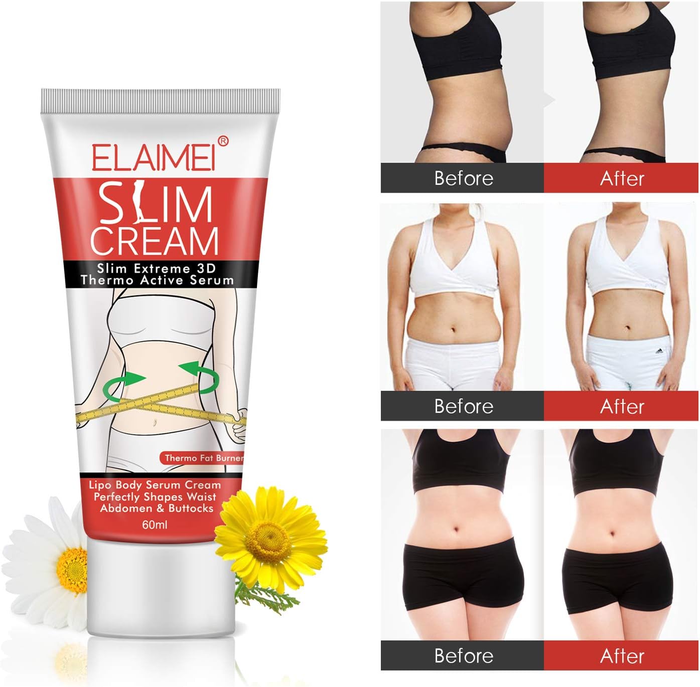 کرم یا ژل موضعی بدن ELAIMEI