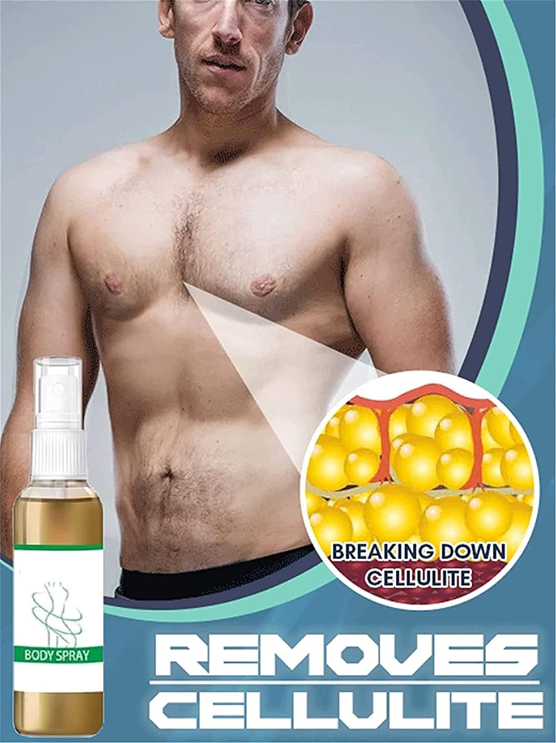 کرم یا ژل موضعی بدن Hikaka 30ml Cellulite Melt Spray Gynecomastia | 30 میلی‌لیتر