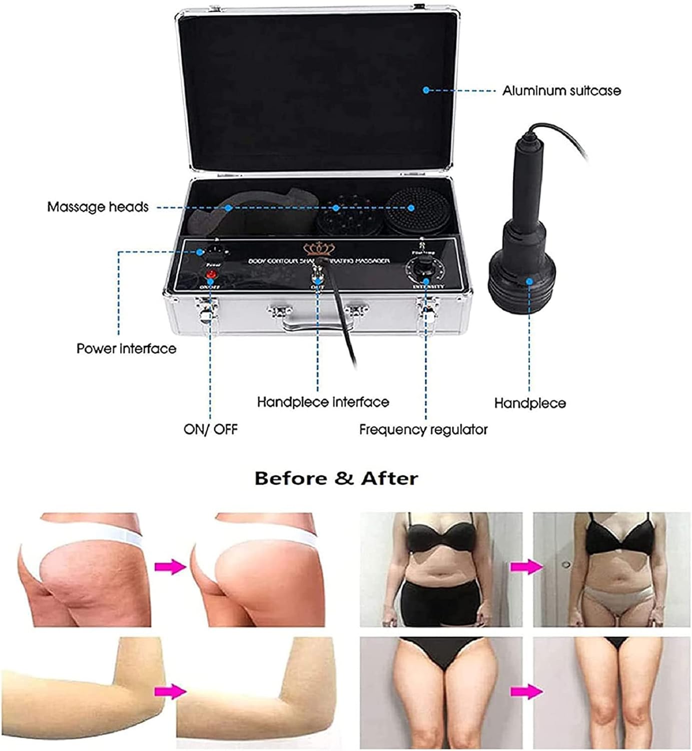 دستگاه فرم‌دهی و ماساژ بدن HENGMA Frequency G5 Cellulite Vibration