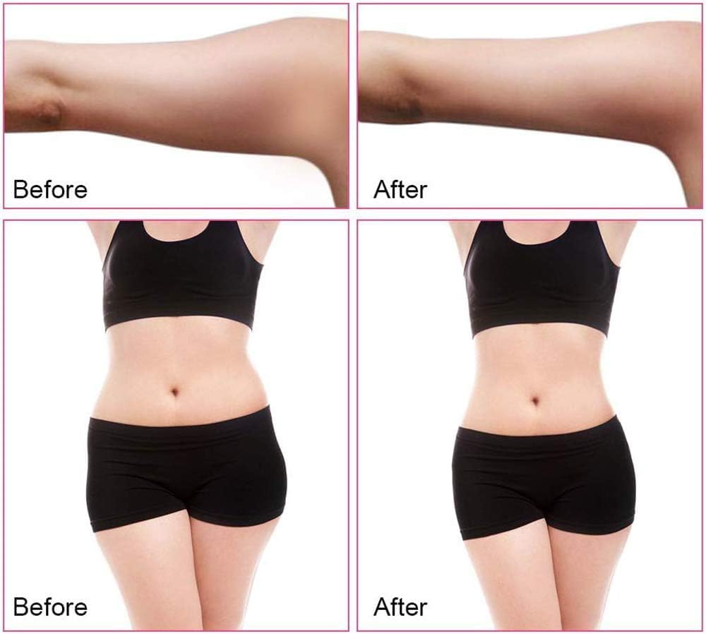 دستگاه فرم‌دهی و ماساژ بدن GZDUTS 40k Anti-cellulite